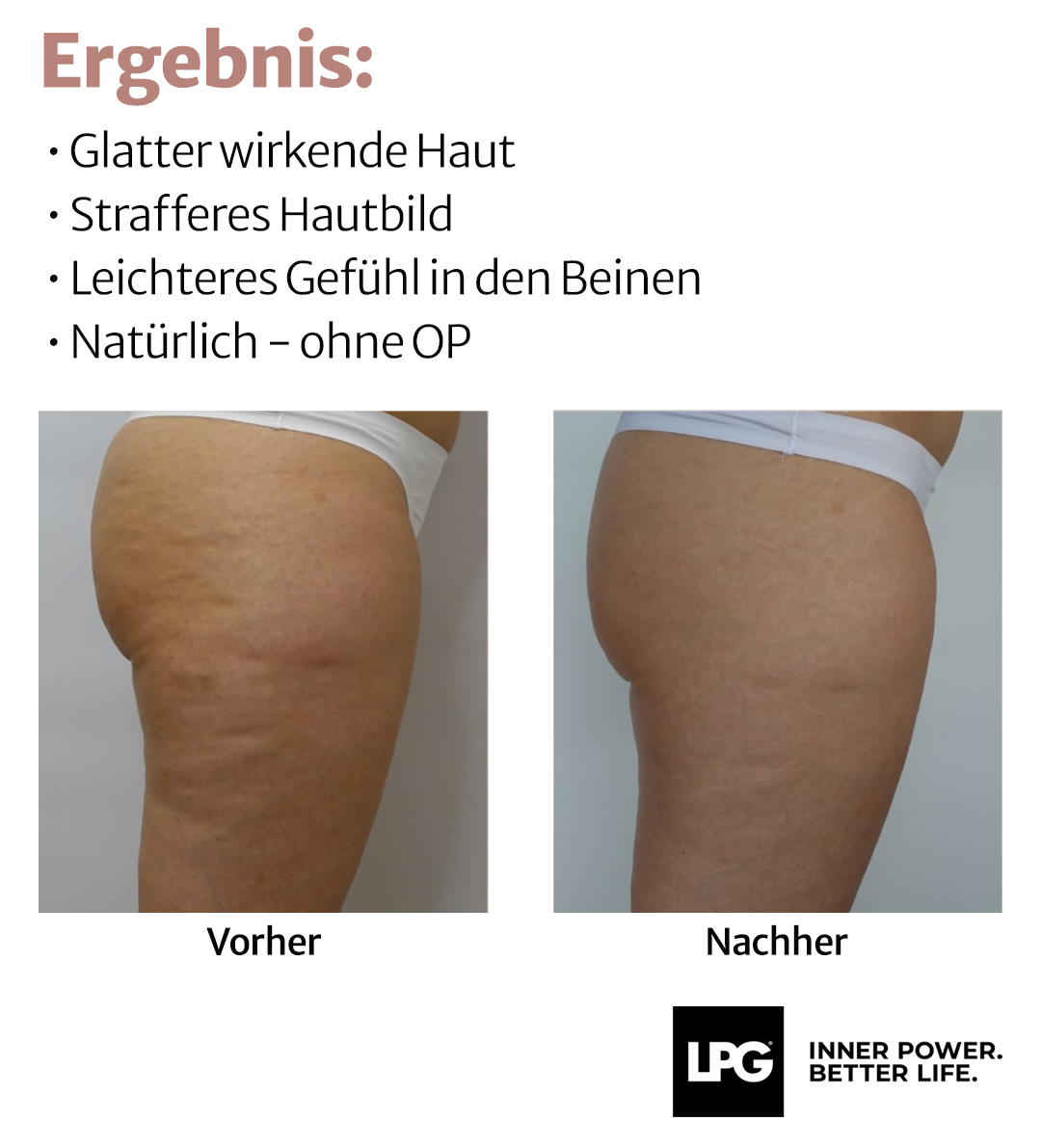 voerhernachher